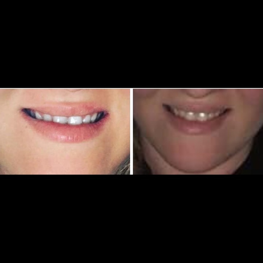 Free toothpaste - Picture 2 of 3